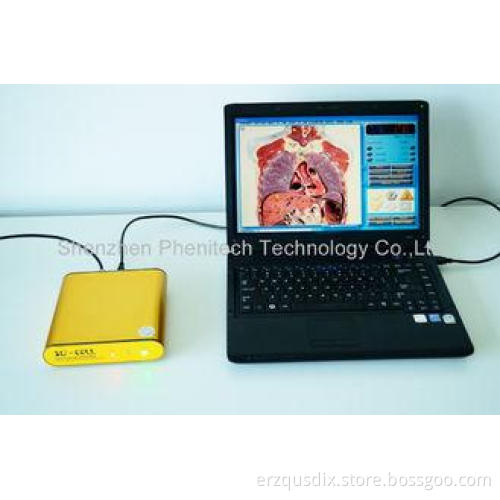 OEM Golden Computer System 3D NLS Sub Health Analyzer For B